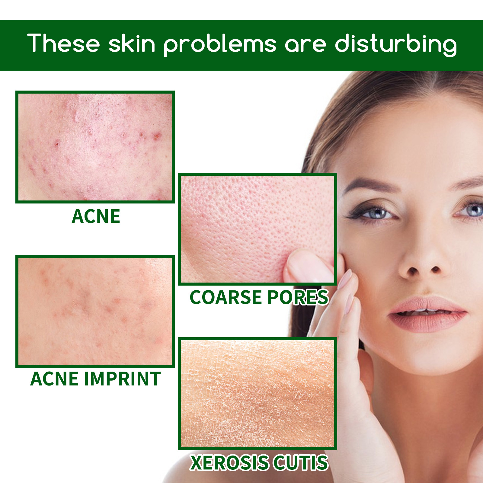 Salicylic Acid Anti Acn-e Face - Azelaic Acid Serum のレビューと価格