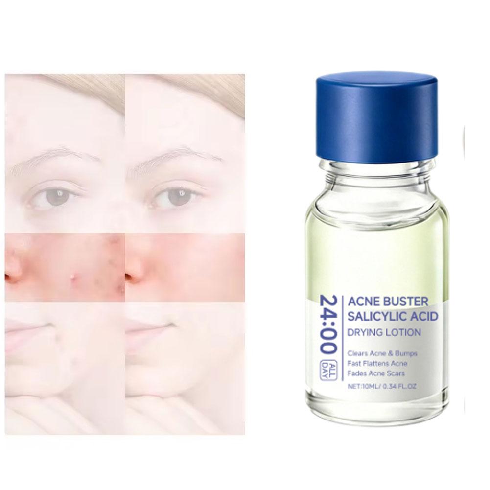 Salicylic Acid Acne Care Serum - Azelaic Acid Serum のレビューと価格