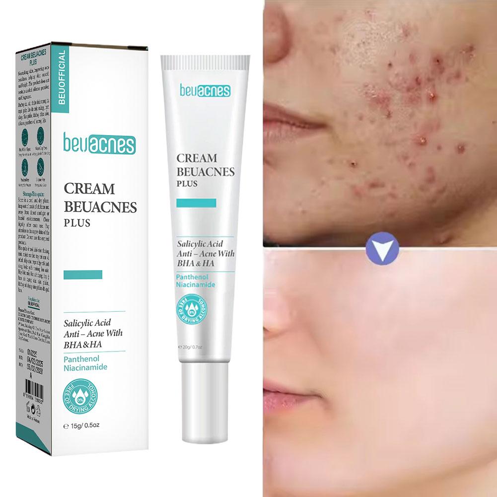 New 20g Niacinamide Acne Gel A - Skincare Niacinamide のレビューと価格