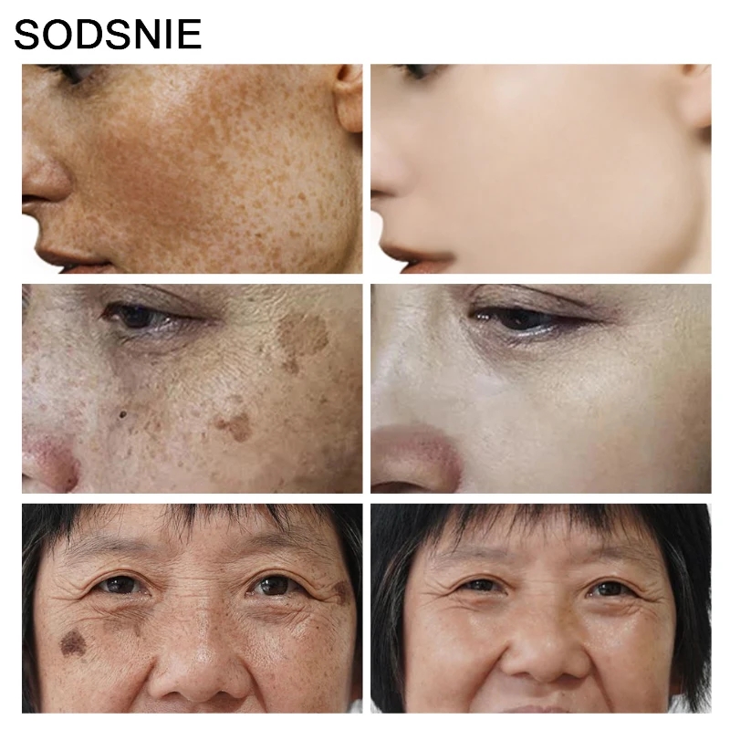 Dark Spot Remover Vitamin C Wh - Skincare Niacinamide のレビューと価格