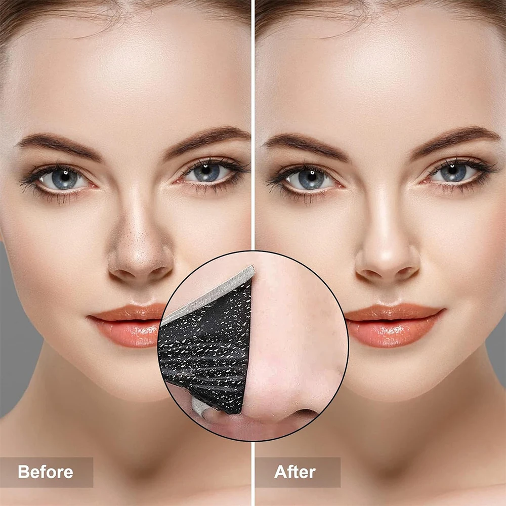 10PCS Unisex Blackhead Remove  - Skincare Indonesia のレビューと価格