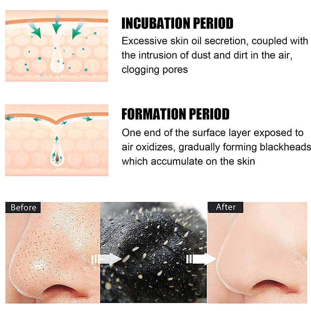 10PCS Unisex Blackhead Remove  - Skincare Indonesia のレビューと価格