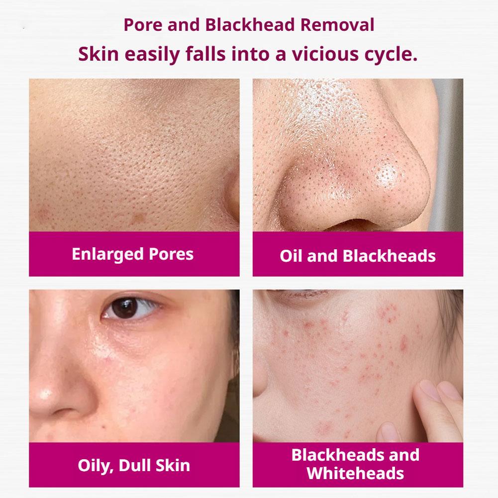 Salicylic Acid Shrink Pores Se - Azelaic Acid Serum のレビューと価格