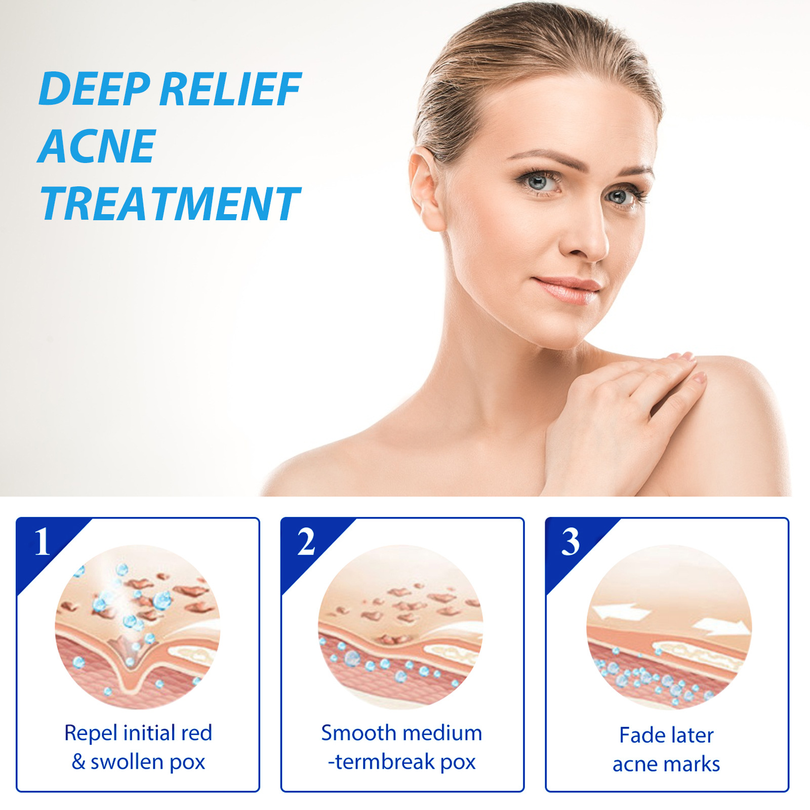 EELHOE Acne Treatment Lotion S - Azelaic Acid Serum のレビューと価格