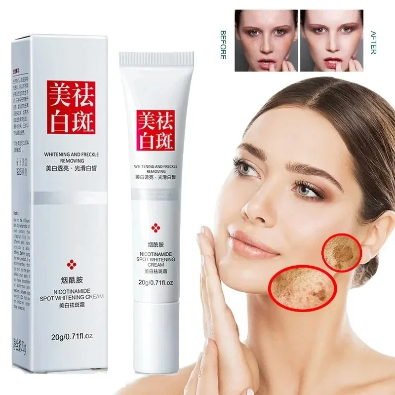 Fades Freckle Dark Spots Face  - Skincare Niacinamide のレビューと価格