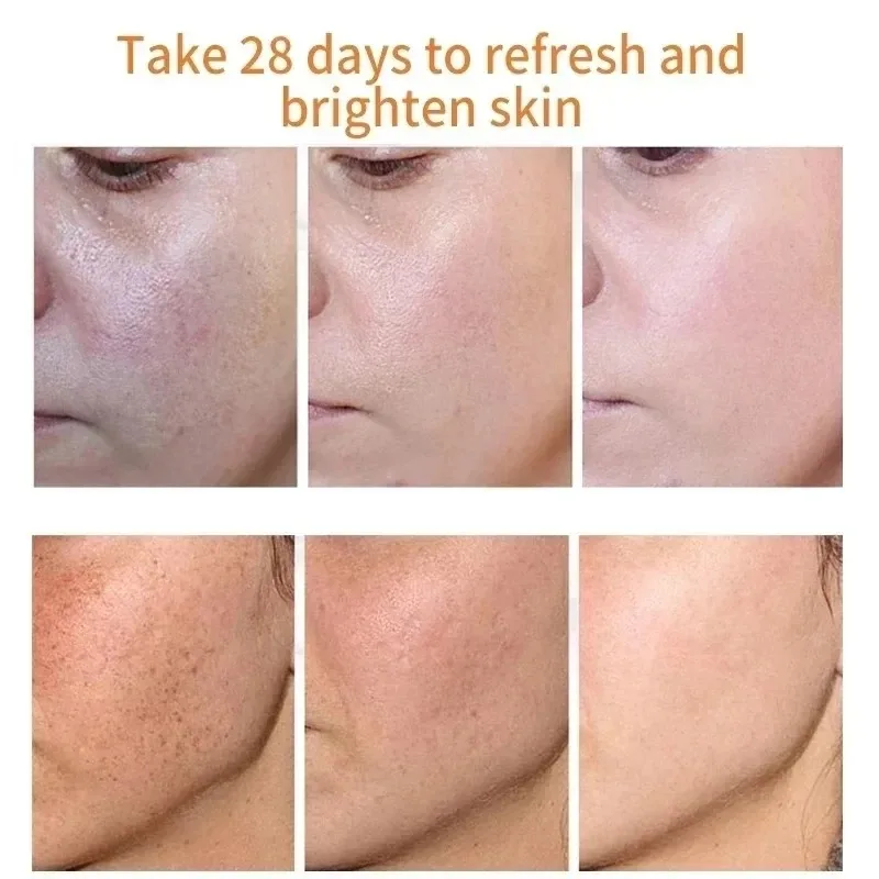 Fades Freckle Dark Spots Face  - Skincare Niacinamide のレビューと価格