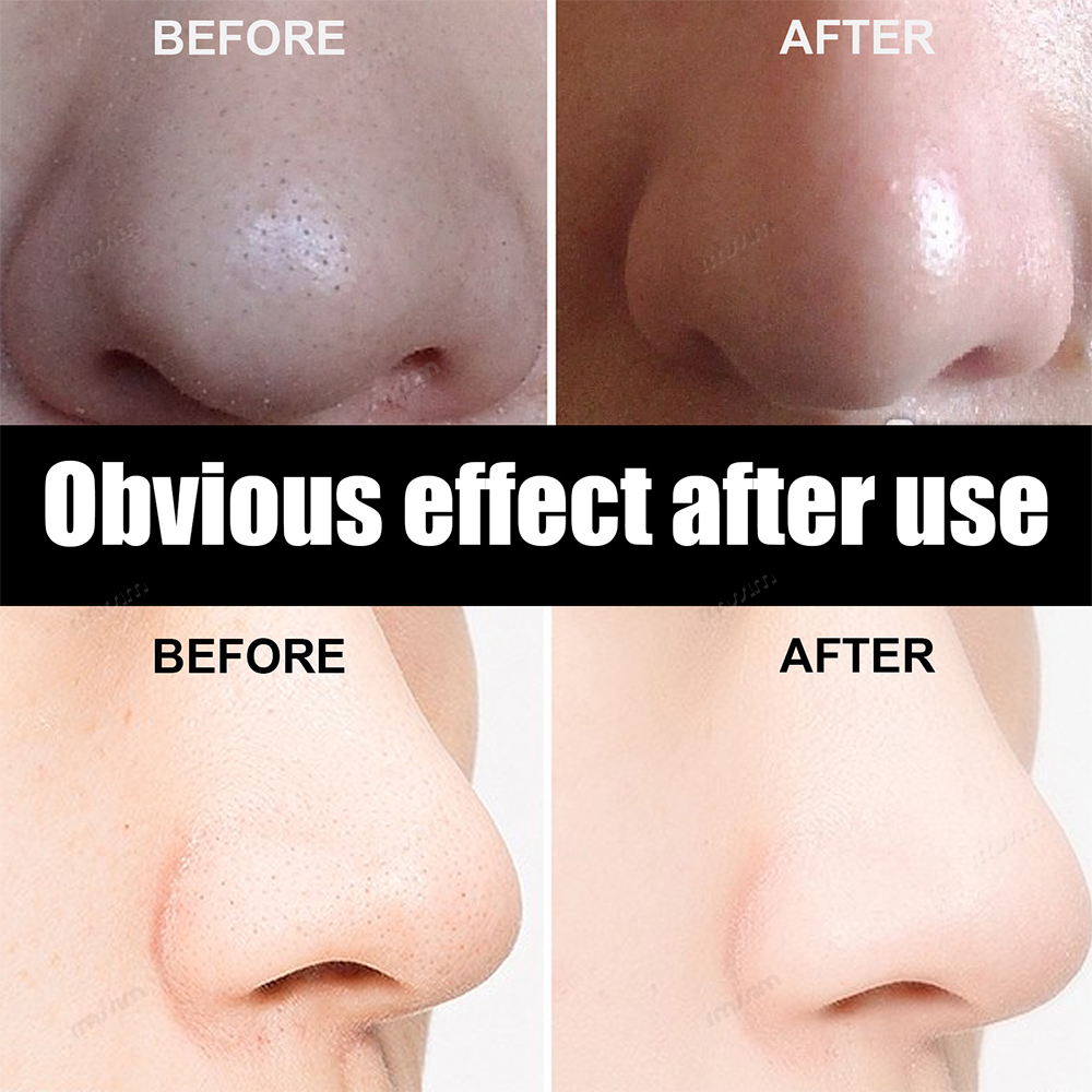 New 10-100pcs Unisex Blackhead - Skincare Indonesia のレビューと価格
