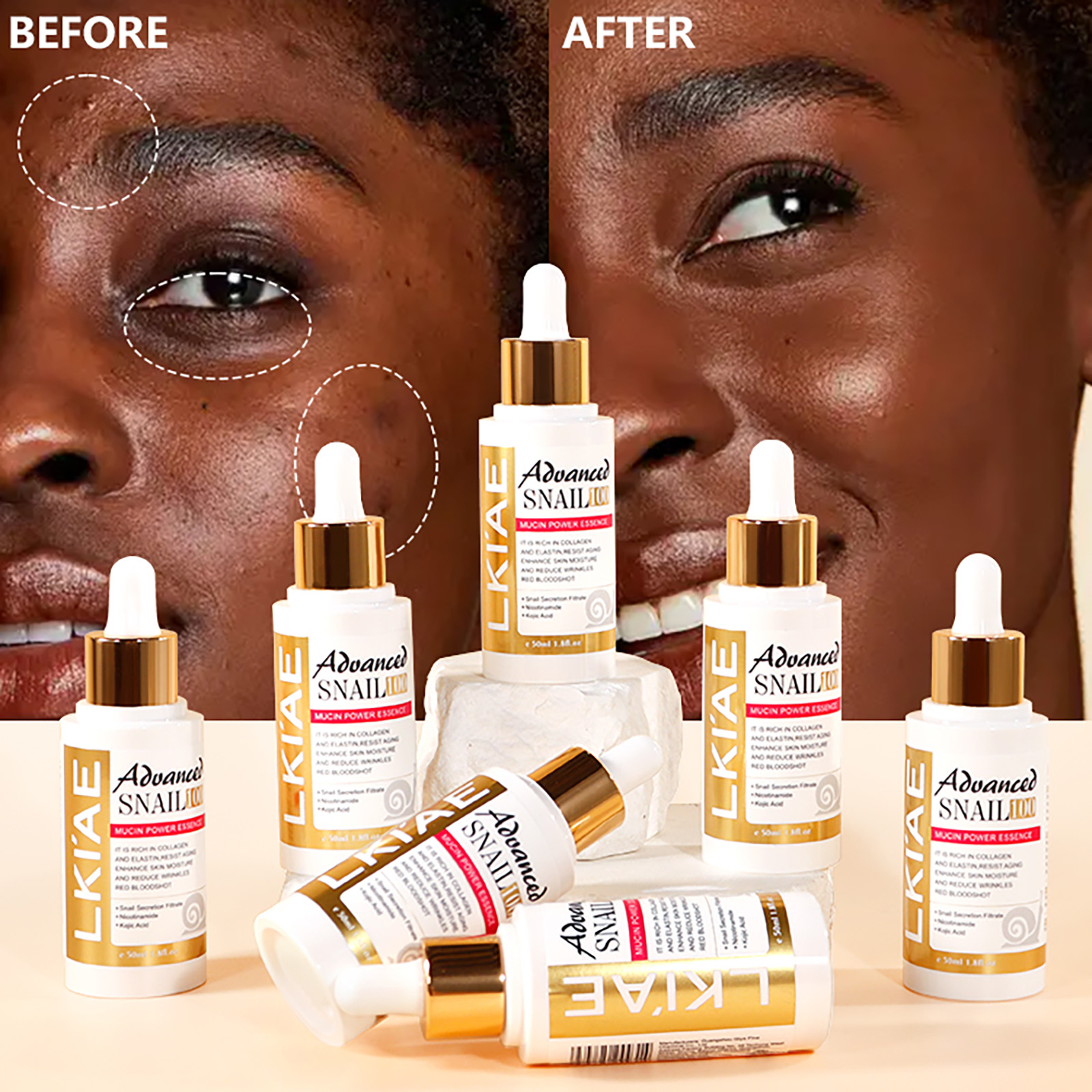 LKIAE Advanced Snail Mucin Pow - Snail Mucin Essence のレビューと価格