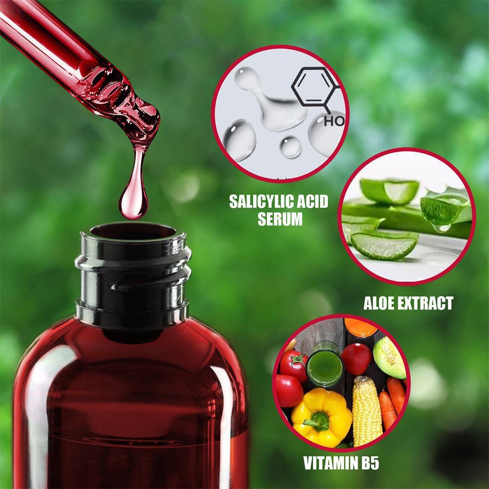 30ml Salicylic Acid Shrink Por - Azelaic Acid Serum のレビューと価格
