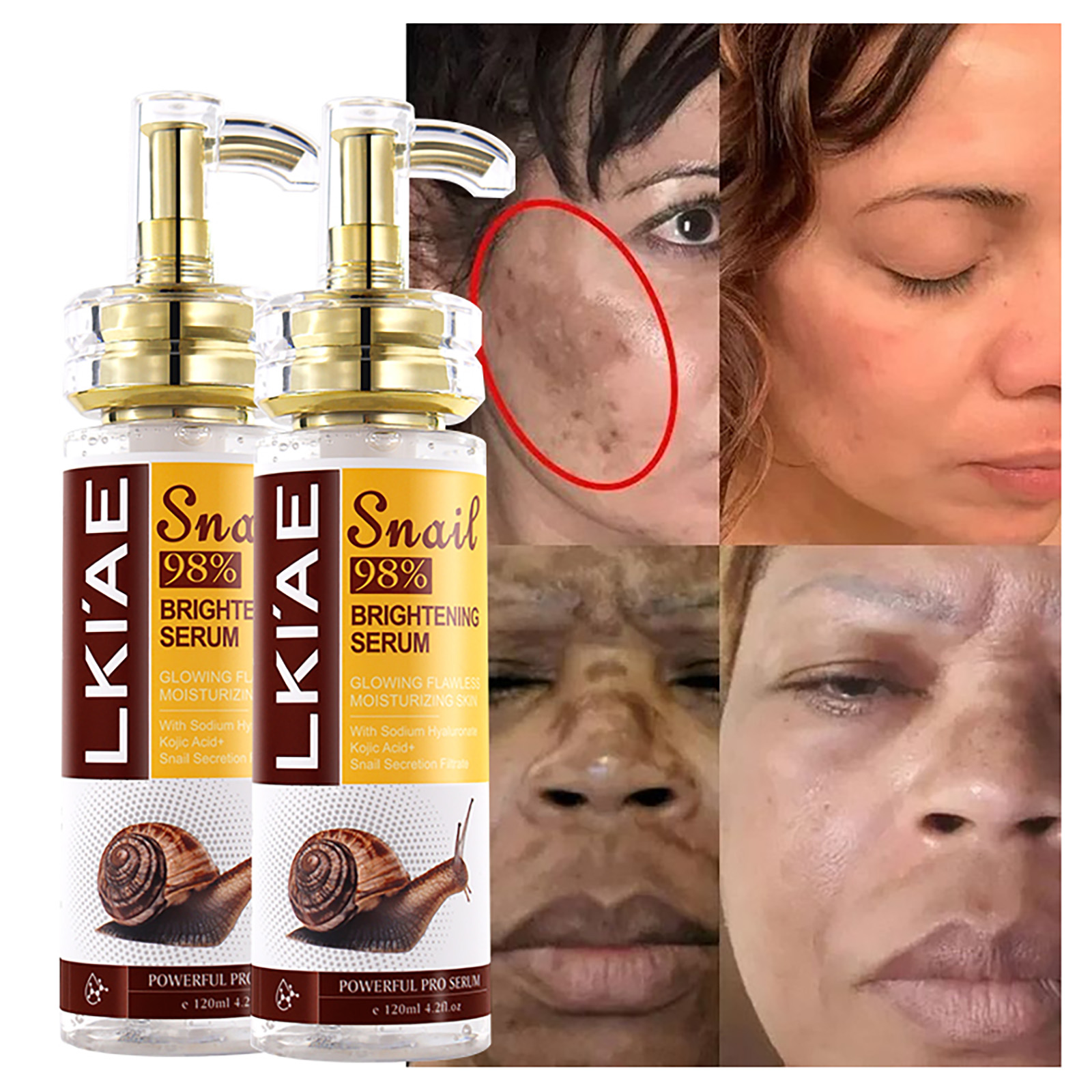 AILKE Snail Extract Whitening  - Snail Mucin Essence のレビューと価格